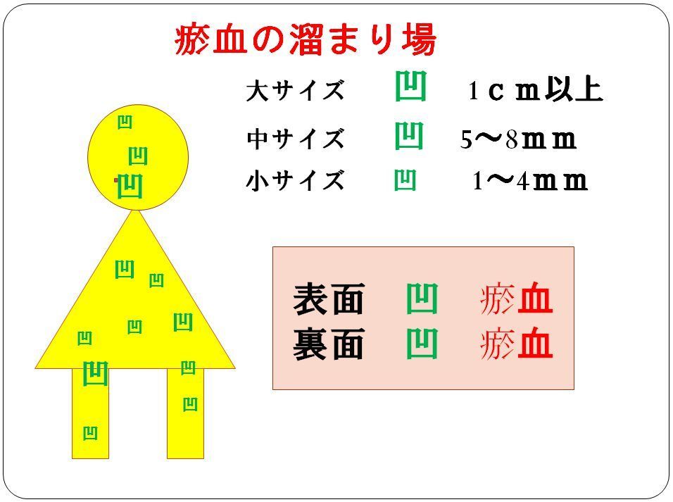 お血の溜まり場.JPG