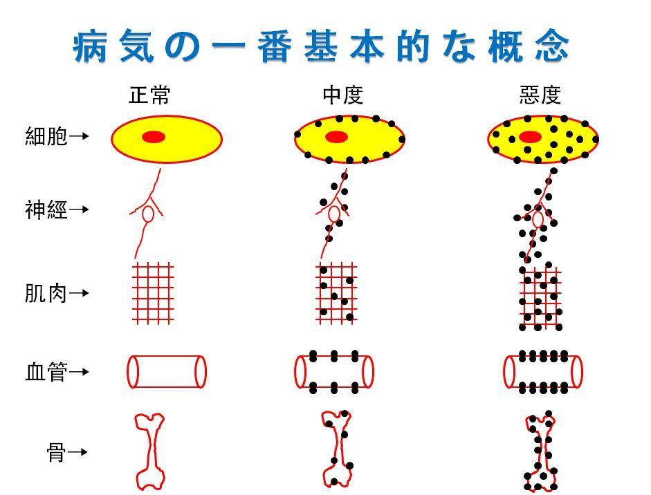 病気の一番.JPG