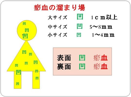 お血の溜まり場.JPG