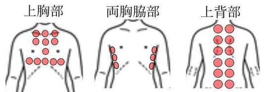 肺炎患者吸引部位.JPG